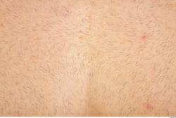 Photo Textures of Human Skin